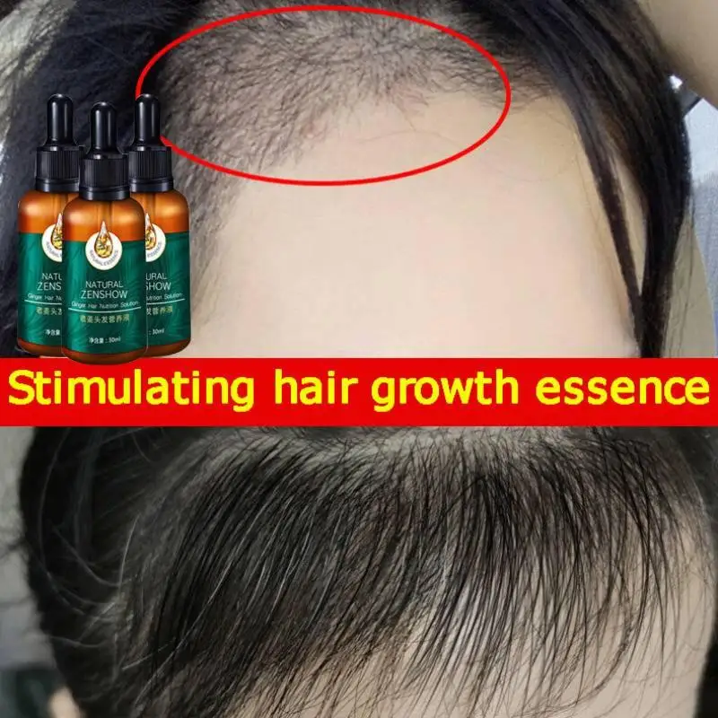 Aceite Esencial de jengibre pa - Hair Care Herbal Products reseña y precio