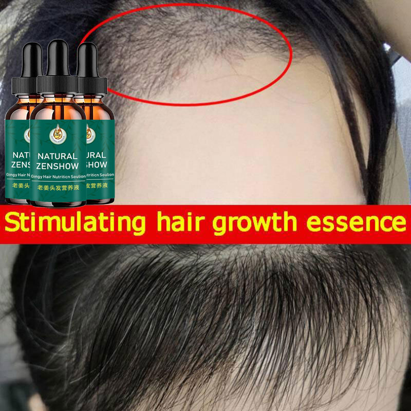 Aceite Esencial de jengibre pa - Hair Care Herbal Products reseña y precio