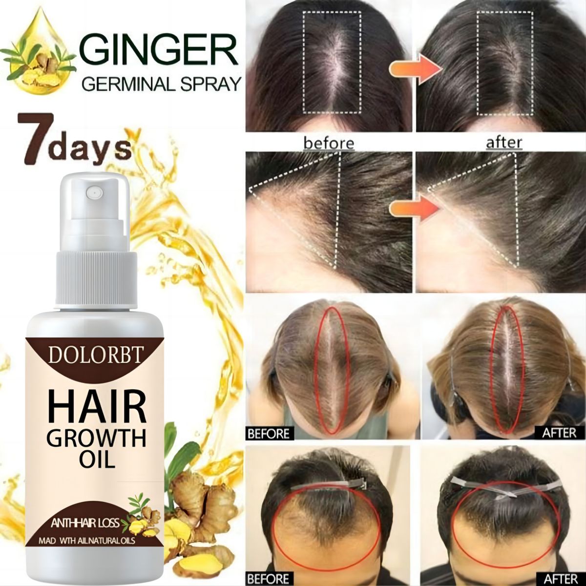 Aceite esencial para el crecim - Hair Care Herbal Products reseña y precio