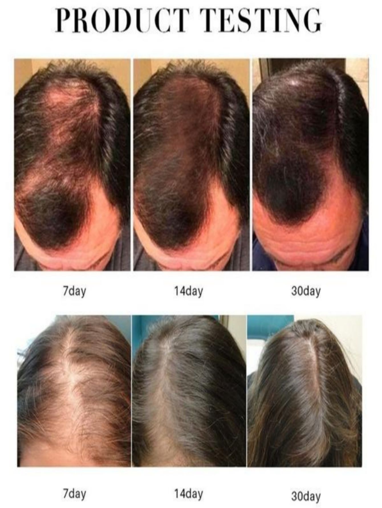 Aceite esencial para el crecim - Hair Care Herbal Products reseña y precio
