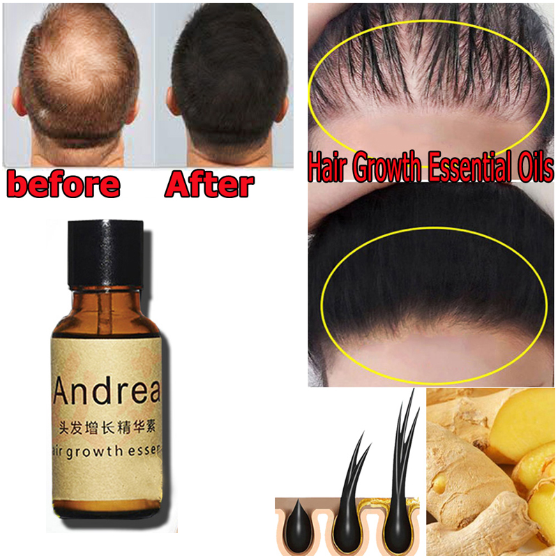 2/5/10 Uds. Aceite de suero pa - Hair Care Herbal Products reseña y precio